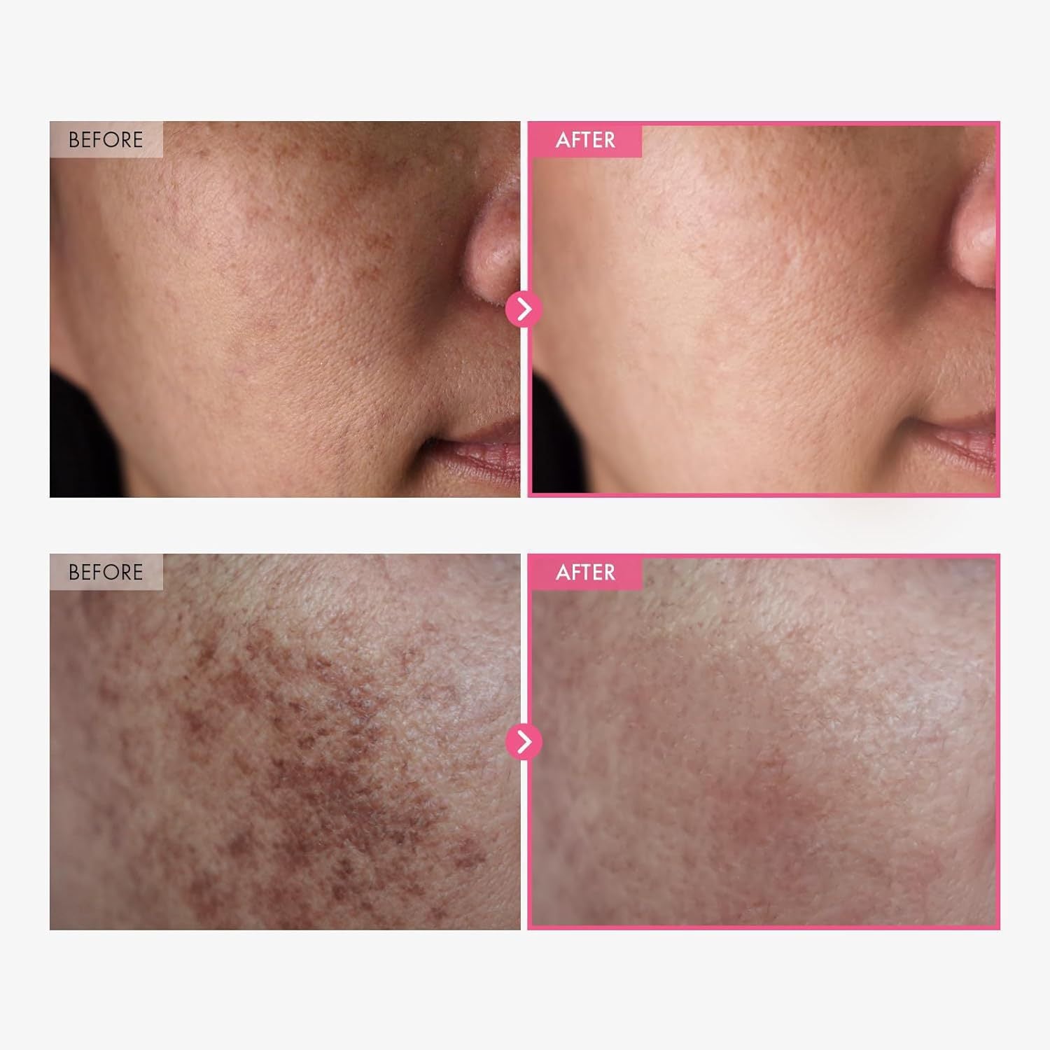 Arbutin Nicotinamide Moisturizing Face Cream